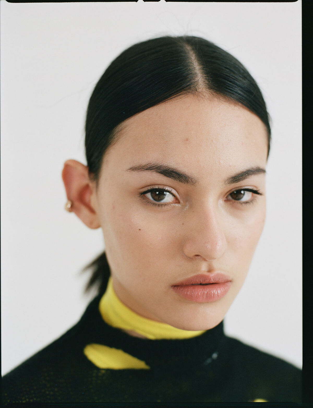 Sind Vitamin Patches wirklich eine wirksame Alternative zu klassischen Wirkstoffen?  (Foto: Tristan Rösler)